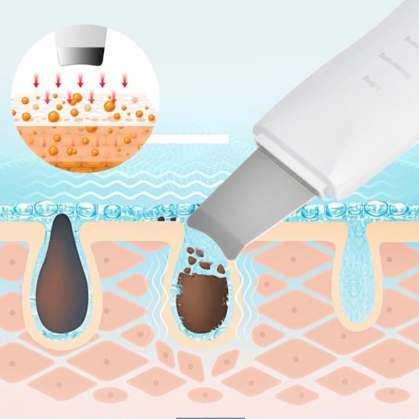 Paleta Ultrasonica Facial Espatula Limpiadora Exfoliante 010 Recargable Peeling Lifting Depurador Skin
