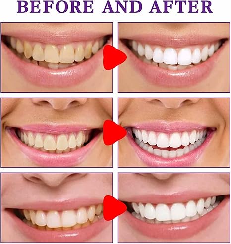 Crema blanqueadora de dientes pasta dental