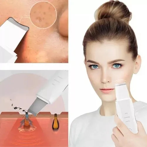 Paleta Ultrasonica Facial Espatula Limpiadora Exfoliante 010 Recargable Peeling Lifting Depurador Skin